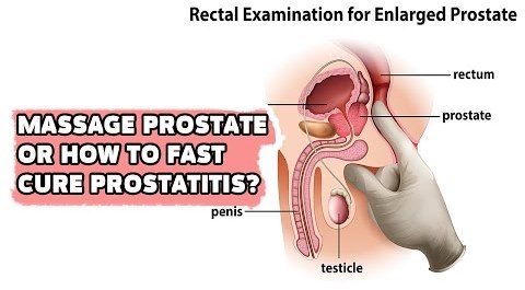 extander prosztatitis